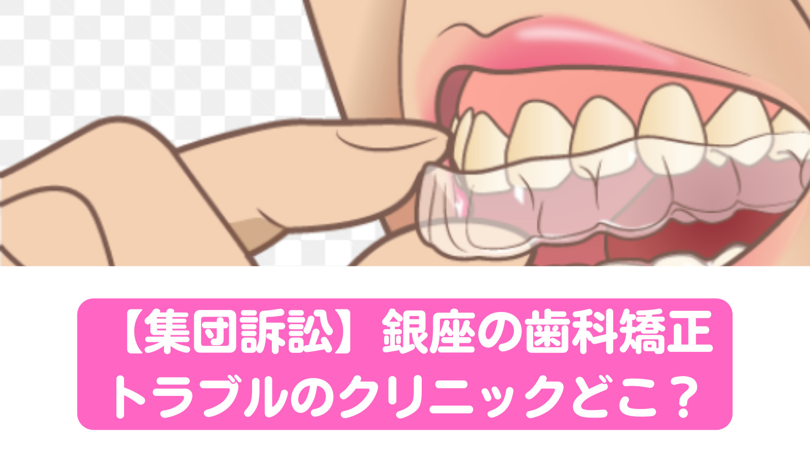 歯科矯正デンタルオフィスX
